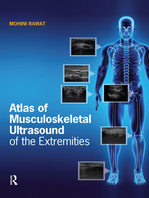cover image of Atlas of Musculoskeletal Ultrasound of the Extremities